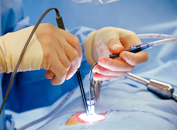 Micro Invasive Neuro Surgery in Jaipur